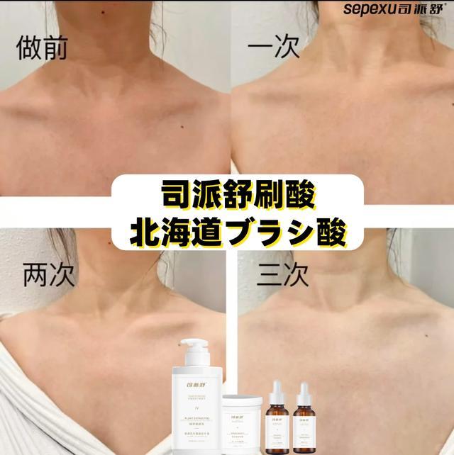 试下司派舒北海道全身刷酸pg电子平台拒绝黑黄粗糙